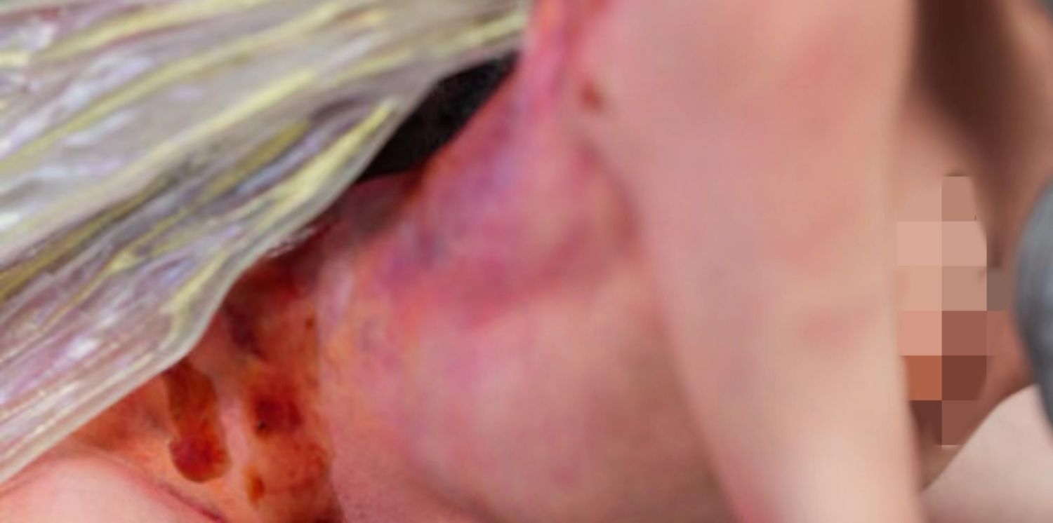 1/6 Scale Parasitized Fairy Model Kit